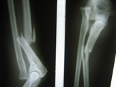 coimbatore-orthopaedic-joint-replacement-maternity-child-welfare-centre-india